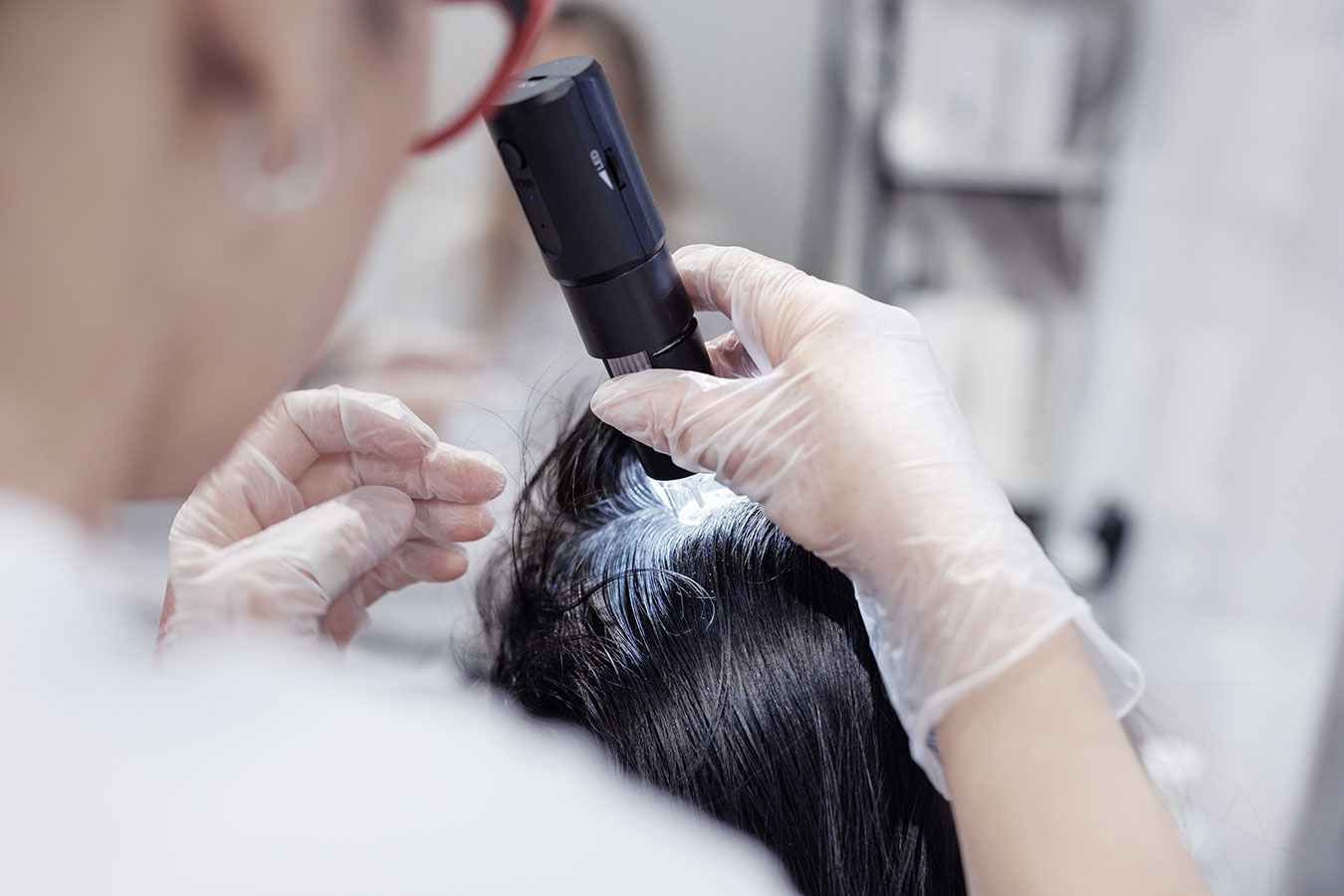 Hair Restoration Treatment