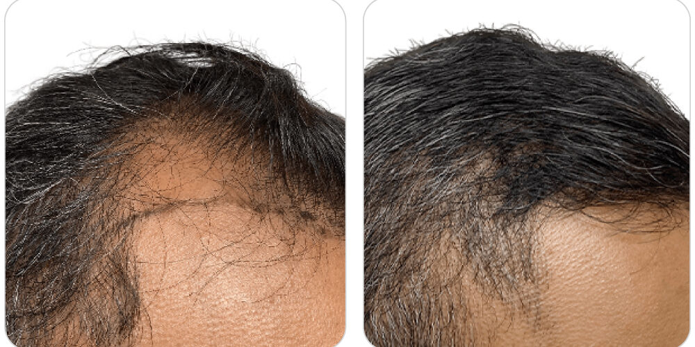 before&after-2 before and after