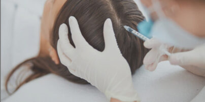 scalp micropigmentation cost philippines