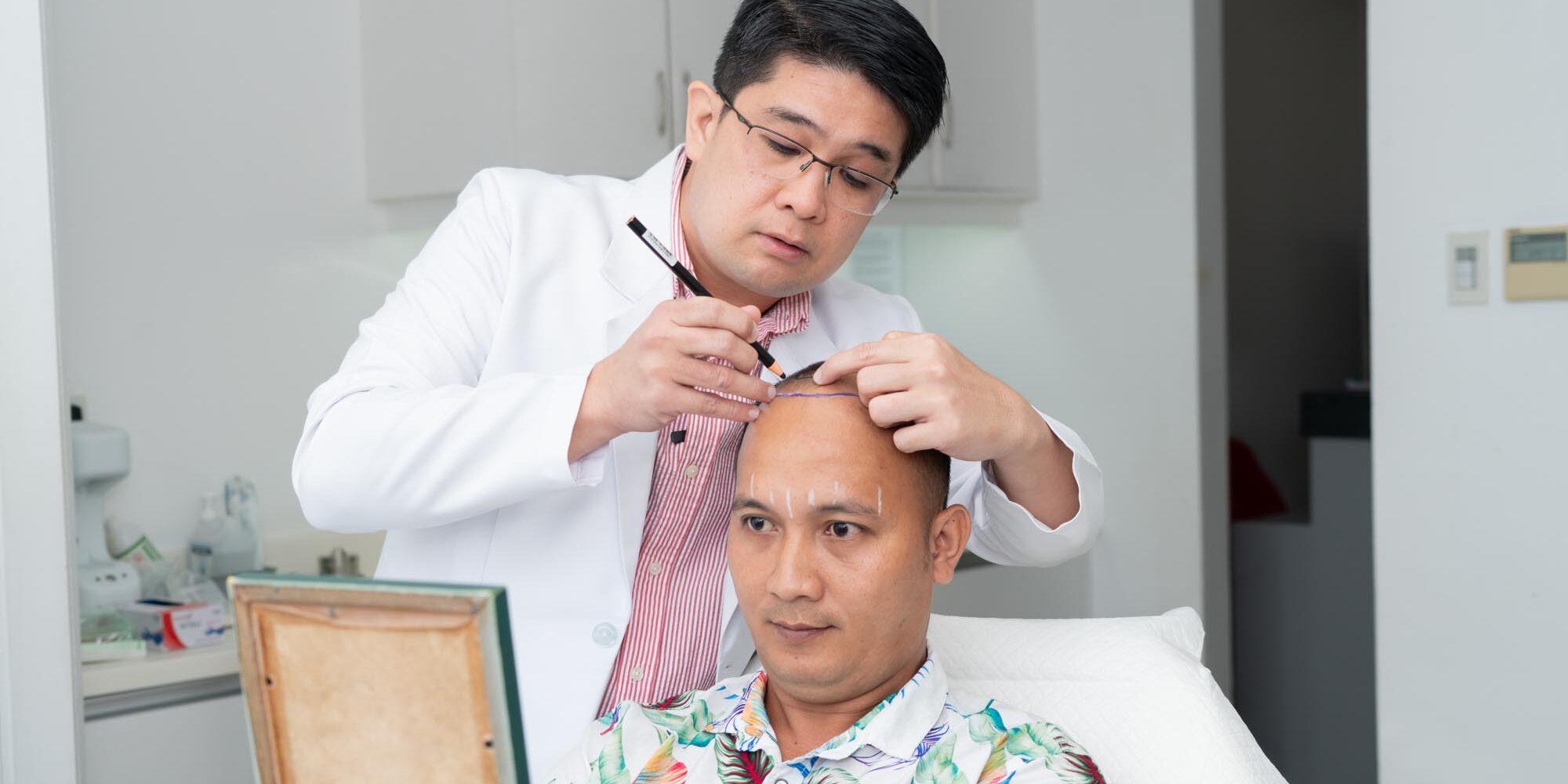 stem cell therapy for hair loss