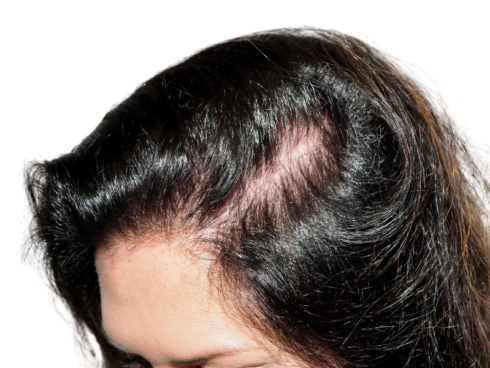 shampoo for hair growth in the Philippines