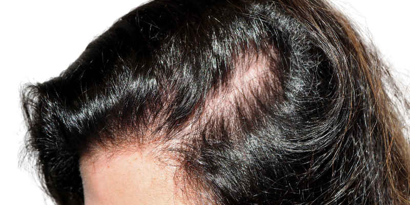 Lor-SM-20221022T202701Z-001-BEFORE-3 shampoo for hair growth in the Philippines