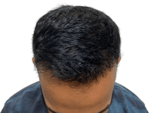 how to make your hair grow faster