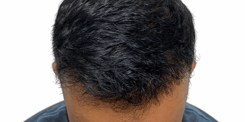 how to make your hair grow faster