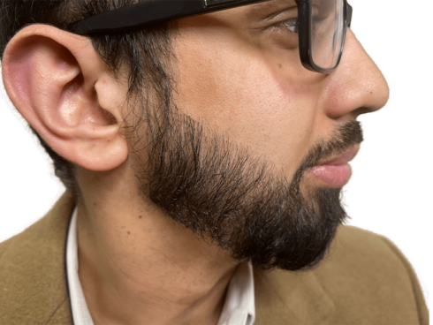 How to Grow Facial Hair