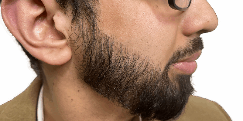 How to Grow Facial Hair