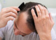 How to Stop Hair Thinning