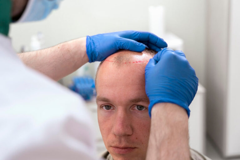 right hair transplant clinic in Manila