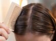 how to have healthy scalp