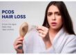 pcos hair loss