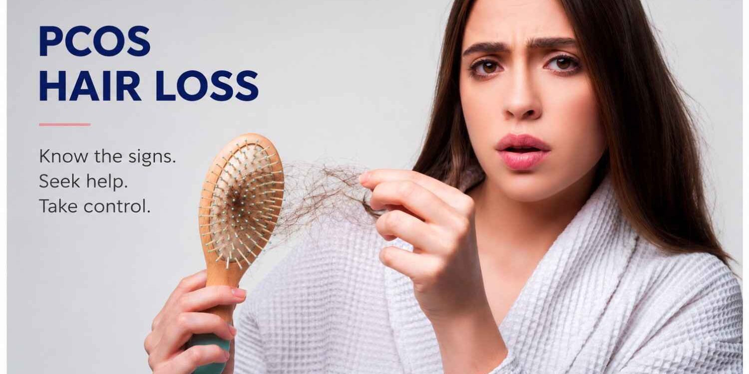 pcos hair loss