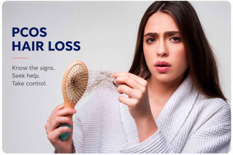 pcos hair loss