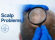 scalp problems