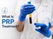 what is prp treatment