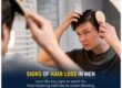 signs of hair loss in men