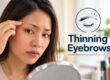 thinning eyebrows