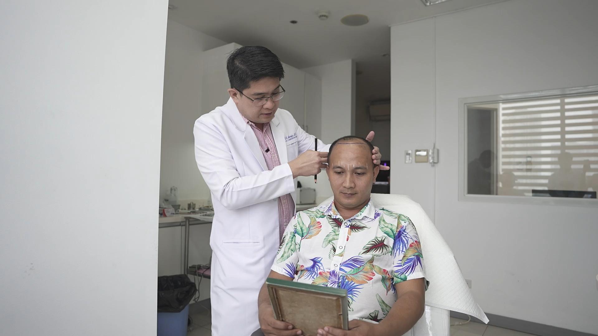 hair transplant consultations in cebu